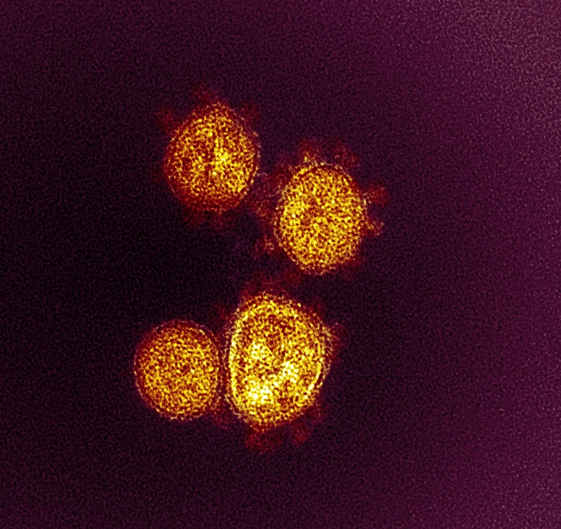 image_processing20210805-20057-13kcaul