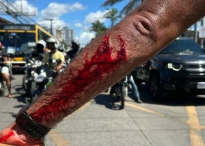 braco-quadrado-750x536